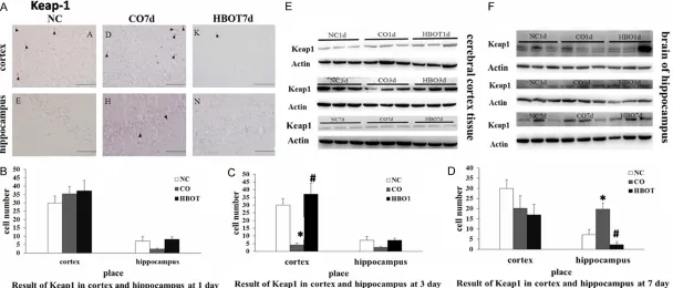 Figure 2. Immunohistochemical staining and Western blot of Keap1. Keap1-positive cells in the cerebral cortex tissue and hippocampus from rats of the CO group were not significant different with that of the NC group at 1st day (B) and 7th day (A, D) and le