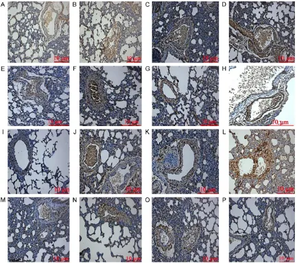 Figure 2. Immunohistochemical staining of HSP70, HIF-1α, ET-1, and iNOS in the lung tissue of newborn rats (mag-nification, ×400)