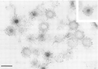 FIG.1.treatedcontrasted Preembedding immunolabeling of ASF virus particles with a serum against purified virions
