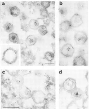 FIG. 5.withlabeled17K.G6, Postembedding immunolabeling of ASF virus particles with either MAb 17A.H2, specific for proteins p220 and p150, or MAb specific for protein p150