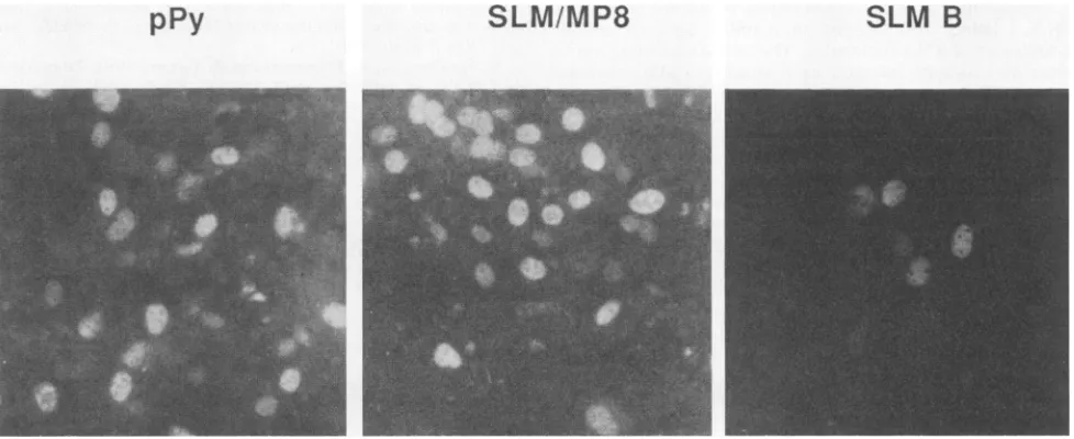 FIG. 6.staining Characteristic bursts for wild type and two substituted leader mutants