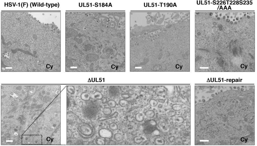 TABLE 2 Effects of the mutations in UL51 on the distribution of viral particles in HSV-1-infected HaCaT cells