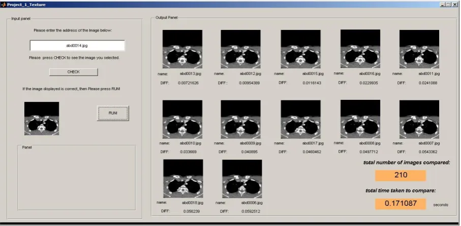 Figure 3 displays texture based retrieval results for T. Where T = T1+T2+T3+T4+T5.  It is observed from this result that, the combined value of the Precision is 1 (100%), which is more accurate than the individual feature Precision