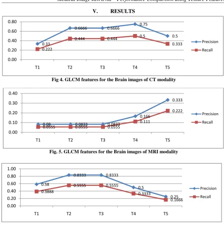 Fig. 5. GLCM features for the Brain images of MRI modality