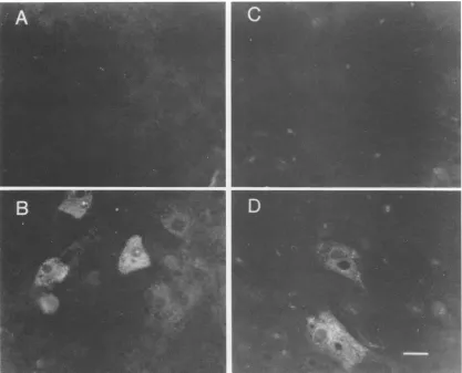 FIG. 4.andpostplating Indirect immunofluorescence of cultured hepatocytes. Panels A and B are uninfected and infected cells, respectively, fixed 9 days and stained for the presence of DHBcAg