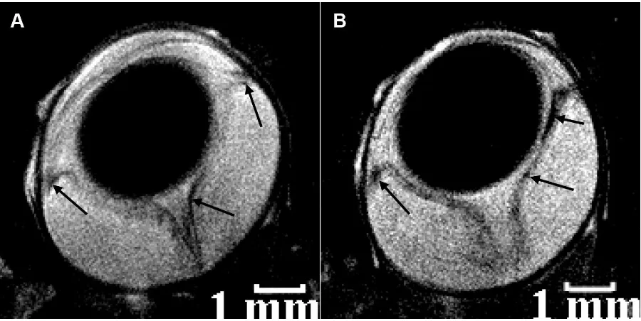 Figure 5. Selected in vivo magnetic resonance imaging transverse sections of rat eyes at the peak of experimental physiologic saline and autoimmune uveitis