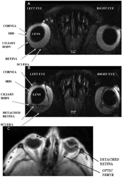 Figure 2. Selected regions of in vivo MRI images of the rat (the lens, cornea, iris, ciliary body, retina and sclera are visualized