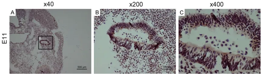 Figure 1. Bmi1 staining in the otocyst on E11, which is shown at three magnifications.