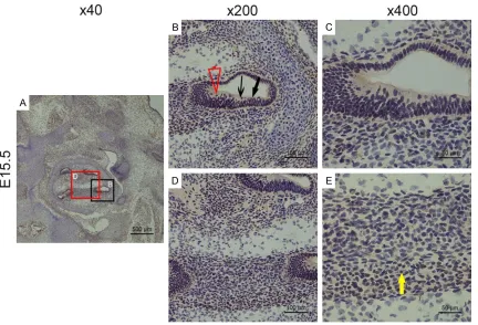 Figure 2. Bmi1 expression was seen in all turns of the cochlear epithelium on E14.5 shown at three magnifications