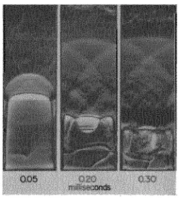 Fig. 14: Initial stages of the shock wave flame and front interaction with three images showing the stages of the 