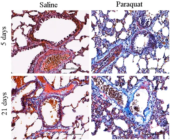 Figure 3. Masson staining on lung tissue collected from rate after treated with saline and paraquat for 5 and 21 days, respectively to observe the changes of collagenous fiber