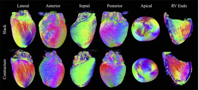 Fig. 5. Tracking of ﬁbre and sheetlet structures in digitally bisected hearts. A to C: Lateral, anterior and apical views of a slack heart with tracking based on v 1 , D to F: v 3 