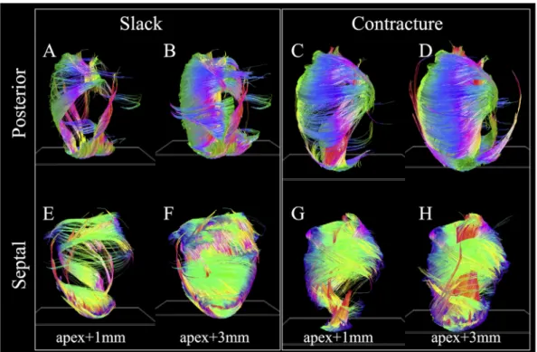 Fig. 7. 3D distribution of v 1 and v 3 helix angles (HA) and transverse angles (TA) across a digitally resected myocardium in slack and contractured hearts.