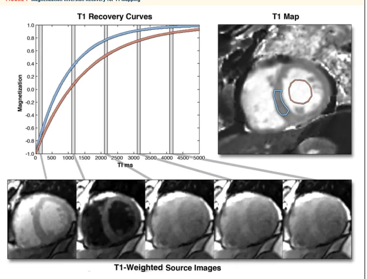 FIGURE 1 Magnetization Inversion Recovery for T1 Mapping