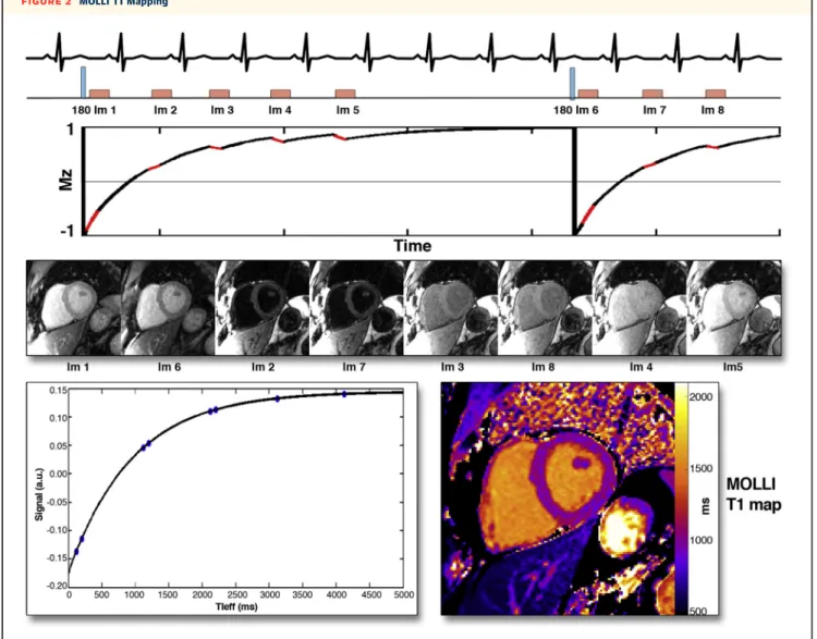 FIGURE 2 MOLLI T1 Mapping