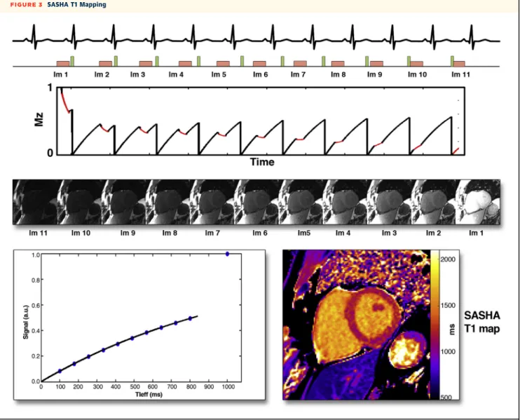 FIGURE 3 SASHA T1 Mapping