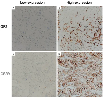 Figure 1. Immunohistochemistry figure of IGF2 and IGF2R. Representative figures of high-expression and low-ex-pression of IGF2 (A and B) and IGF2R (C and D)