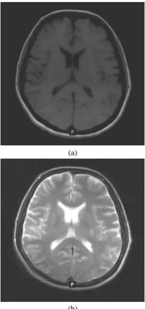 Fig. 1. Original normal MRI1 brain images: (a) T1-weighted MRI1 image and (b) T2-weighted MRI1 image