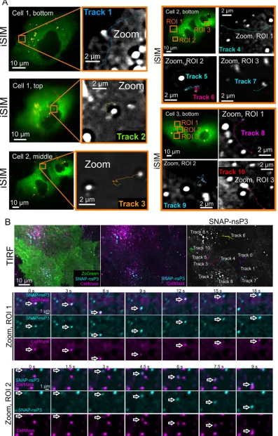 FIG 6 Live imaging of SNAP-nsP3 in stable CHIKV cells showing movement patterns of nsP3-containing granules