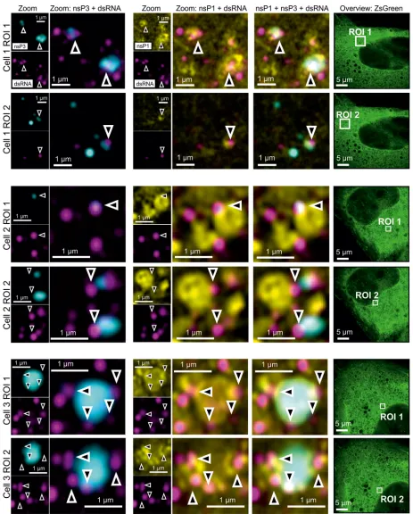 FIG 3 Four-color microscopy of nsP3, dsRNA, nsP1, and ZsGreen. Stable CHIKV cells were ﬁxed and probed for nsP3 (cyan), dsRNA (magenta), nsP1(nsP1), and ZsGreen (green) by a combination of SNAP tag labeling and indirect immunoﬂuorescence assays