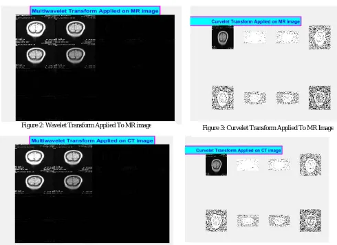 Figure 3: Curvelet Transform Applied To MR Image 