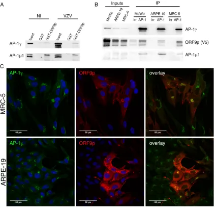 FIG 2 ORF9p interacts and colocalizes with the AP-1 complex. (A) The interaction of ORF9p and the AP-1 complex was veriﬁed by GSTpulldown using ORF9p-GST and total extracts of MeWo cells infected or not infected by pOka VZV