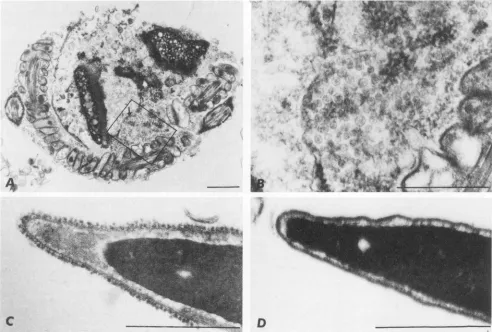 FIG. 2.aoni.t.i.t.MCMV few EM of epididymal sperm derived from MCMV-inoculated mice. (A) An undeveloped sperm containing numerous complete, and incomplete, CMV-like viral particles (arrow) near the acrosome region