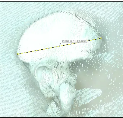 FIGURE 2 – The virtual iliac breadth measurement obtained via Faro SCENE software.  