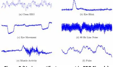 Figure 3 (Various artifacts present in EEG Signals)