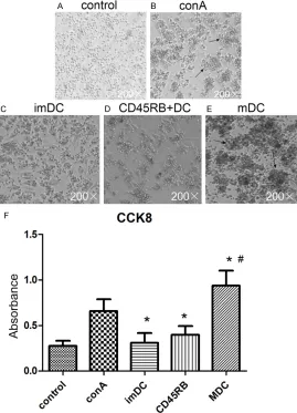 Figure 4. Effect of different DCs on proliferation of CD4+ T cells. (A-E) T cell morphology