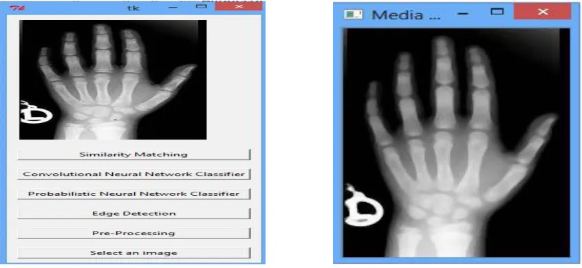 Fig.  2. Proposed System CBMIR PNN-CNN for ImageRetrieval   Fig. 3. Pre-processed Image using Median Filter   