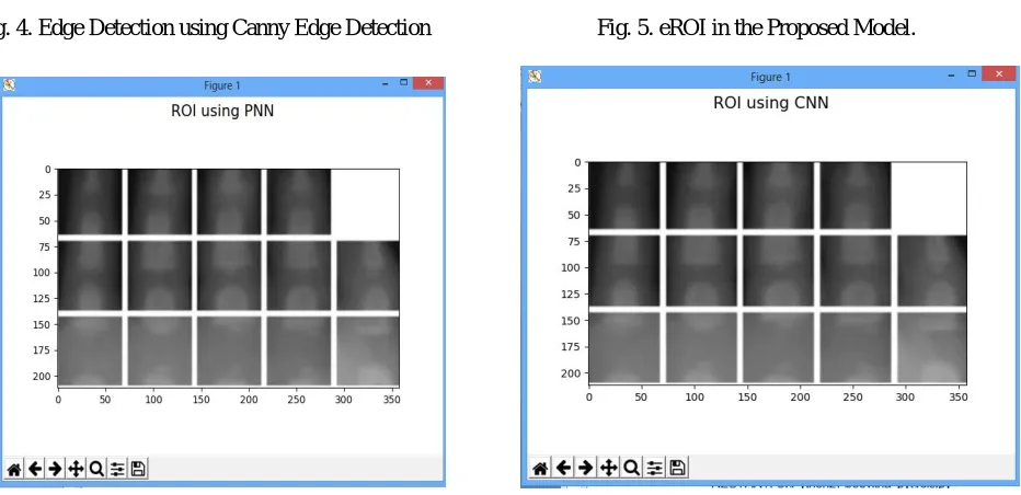 Fig. 4. Edge Detection using Canny Edge Detection                            Fig. 5. eROI in the Proposed Model