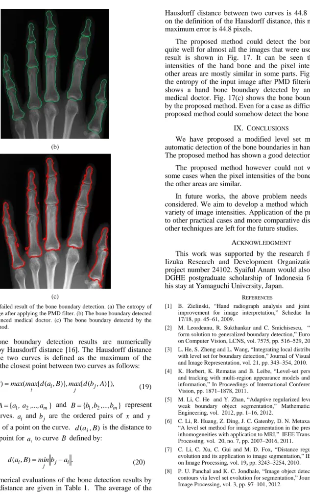 Fig. 17.  One failed result of the bone boundary detection. (a) The entropy of  the input image after applying the PMD filter