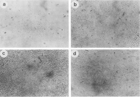 FIG. 2.ofmicroscope.pMLT1.pMLT97. pSV2-neo. Morphology of primary rat embryo fibroblasts transfected with recombinant plasmids, as observed through an inverted (a) pSV2-neo