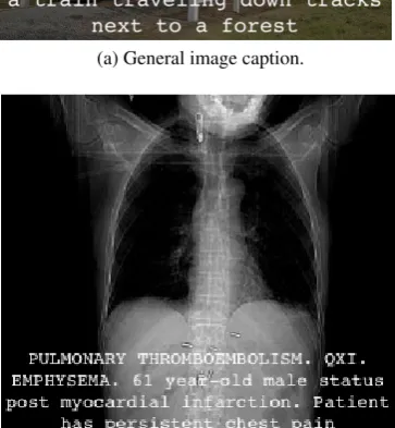 Figure 1: Example of a caption produced by the modelof Vinyals et al. (2015) for a non-biomedical image(1a), and example of a radiology image with its associ-ated caption (1b) from the Pathology Education Infor-mational Resource (PEIR) Digital Library.