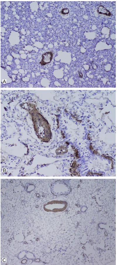 Figure 2. CD34 immunohistochemistry of lung tis-sue (1:200). Note: A: Blank group; B: Model group; C: Shenfuyixin granule group.