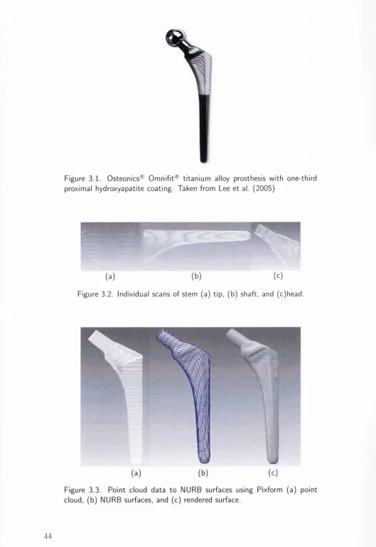 Figure 3.1. Osteonics® Omnifit® titanium alloy prosthesis with one-third 