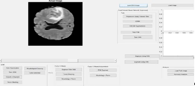 FIG 2: pre-processed image obtained from trilateral filtering. 