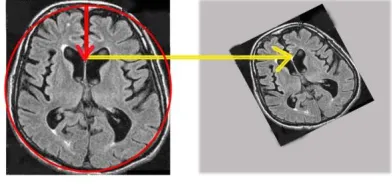 Fig. 1. Feature point extraction and localization procedure for Transaxial T1  MR JPEG image of size 718 kB with resolution 1044 x 2219 pixels