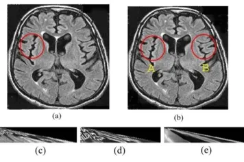 Fig. 2. Example of the proposed image registration approach (a) model image  where the model image is the area inside the circular line, (b) two candidates are chosen as examples using two feature points A and B of the target image, (c) APT of the model im