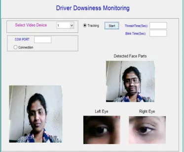 Fig. 5 Detection of eye blinking 