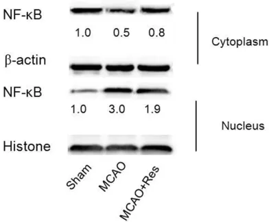 Figure 6. Representative the protein expression of NF-κB in cytoplasmic and nuclear following global cerebralI/R