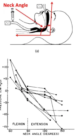 Figure 1 – Study by Wilson et al. [44] (a) experimental setup used (b) closing pressure as a function of neck angle