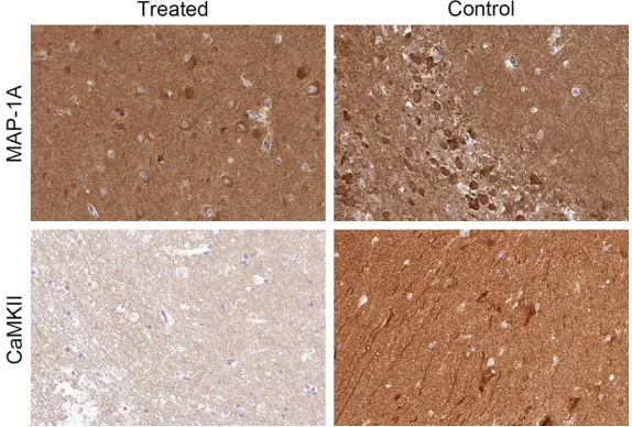 Figure 5. The representative picture of immunochemical staining of serial hippocampal sections for the protein expression difference between control and MRI exposed 2-month rats.