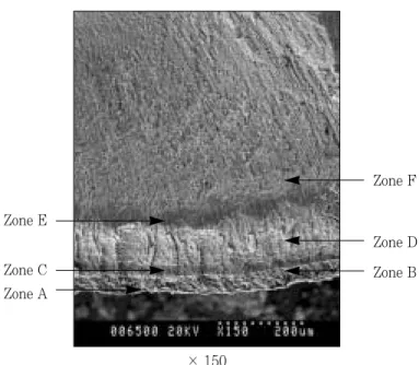 Figure 4.  The  effect  of  the  pH  and  lactic  acid  conce- conce-ntration  in  buffer  solution  on  the  progression  of artificial root caries (㎛).