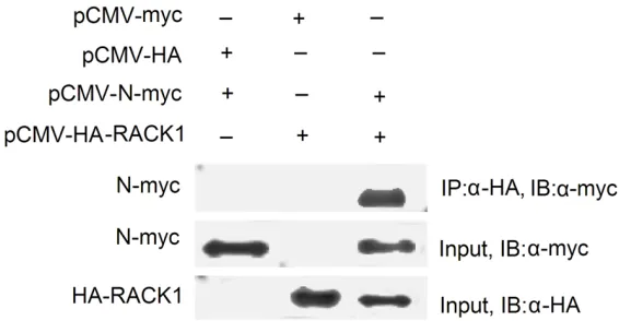 Figure 2. RACK1 protein was immunoprecipitated with the MHV-N protein. Indicated plasmids were simultaneously transfected into 293T cells