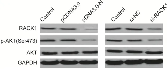 Figure 4. tion AKT signaling pathway. Western blot analysis of p-AKT, AKT and RACK1 protein levels in U2OS cells transfected with N overexpression plasmid MHV-N downregulated RACK1 expression and inhibited activa-(pCDNA3.0-N) or si-RACK1
