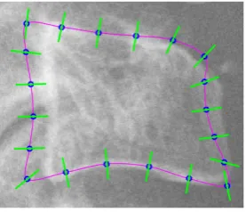 Fig. 1. ASM search: extraction of normal proﬁles. Initialized mean shape (magenta),extracted proﬁles (green) and shape describing points (blue).