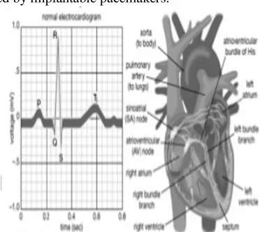 Fig. 1:  Normal Electrocardiogram and human heart. 