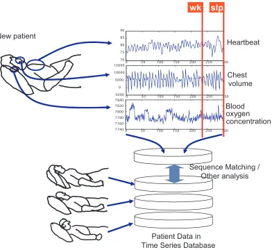 Figure 1.1: Sleep Apnea: An Example of Time Series Analysis [1], wk :wake, slp:sleep